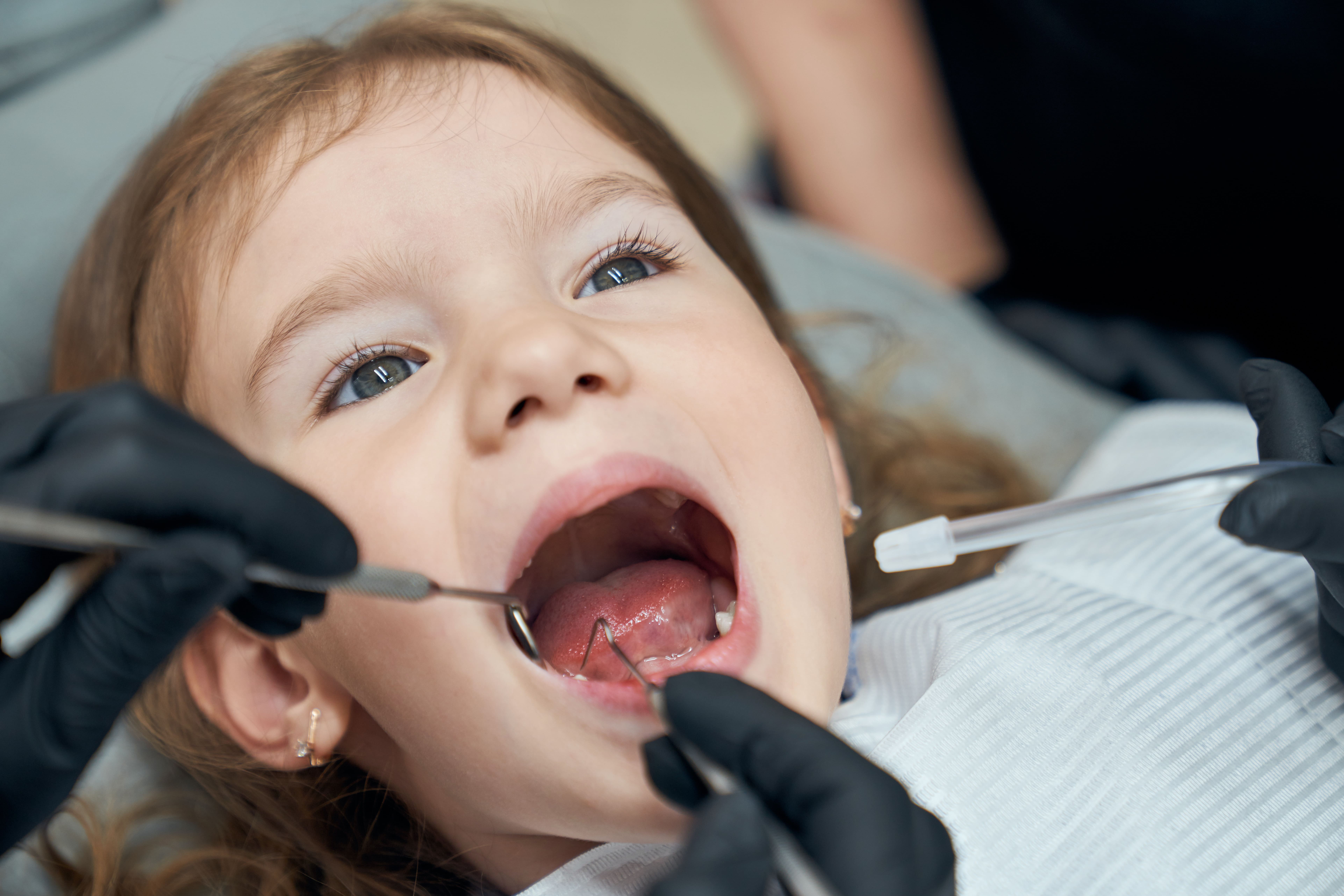 How To Help Children With Dental Anxiety