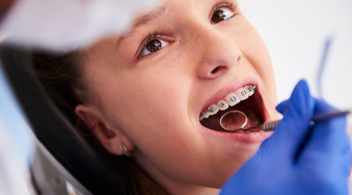 Does My Child Need Braces Common Orthodontic Issues in Kids